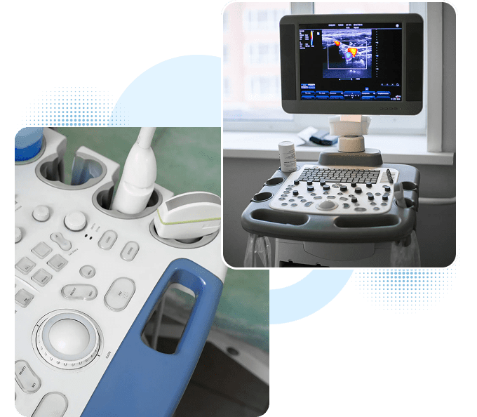 Ultrasound machine with probes and monitor displaying scan.
